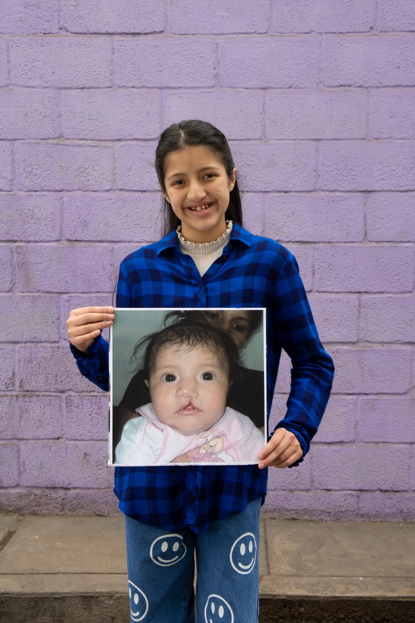 Transformaciones: antes y después