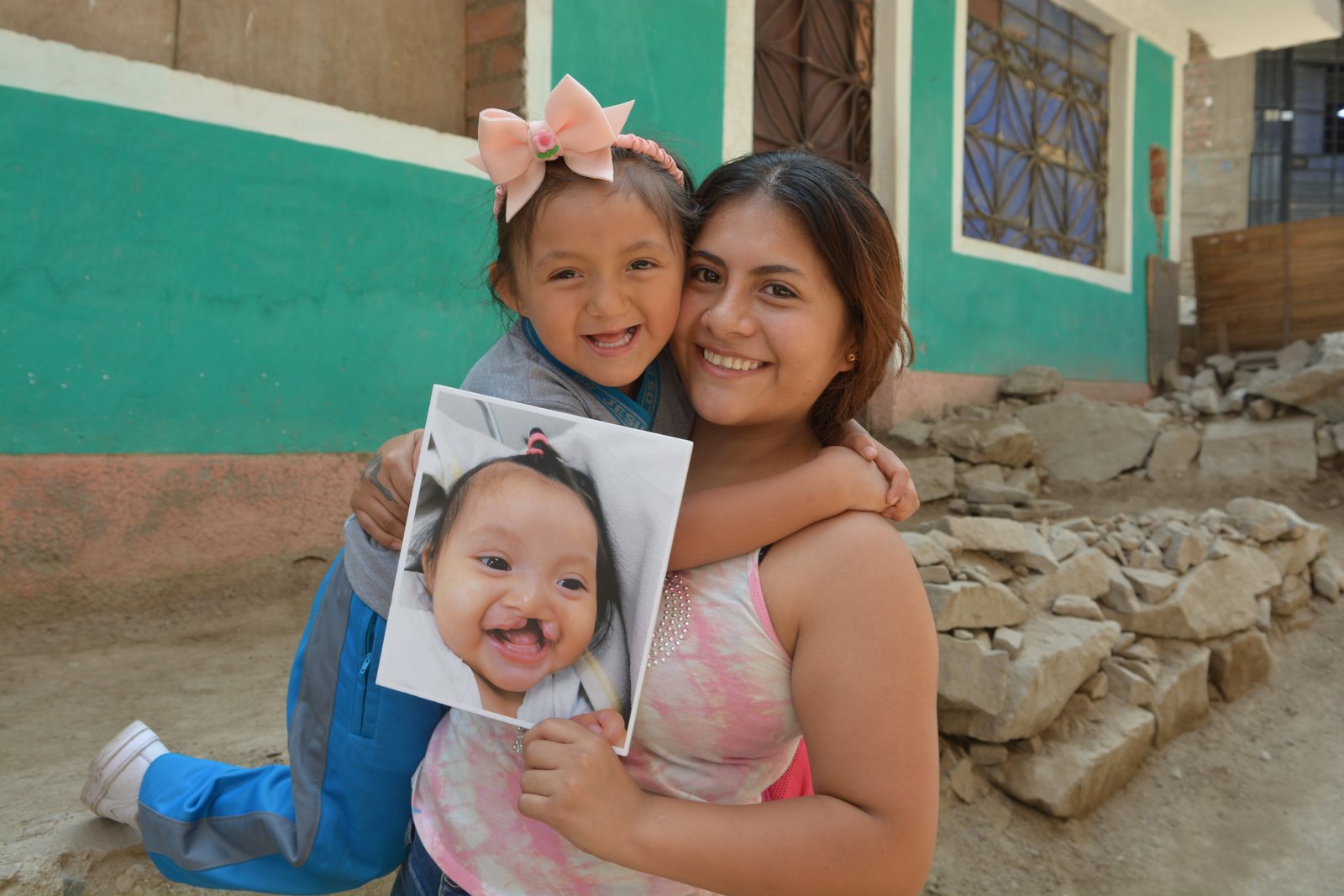 Transformaciones: antes y después
